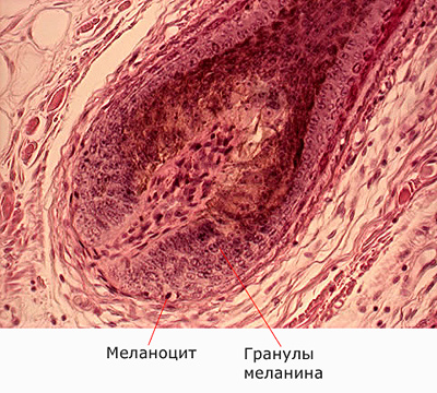 Меланоциты и меланин в луковице волоса Меланоциты и меланин в луковице волоса